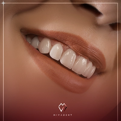 گالری نمونه کار کلینیک دندانپزشکی میوادنت